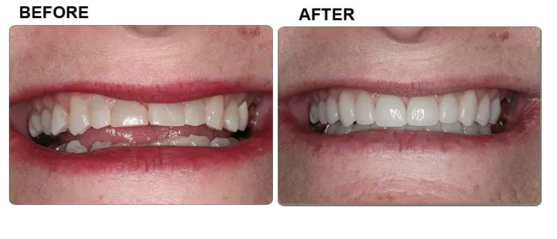 beforeandafter2.png