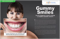 gummy-smiles-dear-doctor